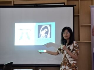 Siloam Hospitals Lippo Village hadirkan CT Scan Low Dose dan operasi paru minim invasif, solusi aman untuk deteksi dan pemulihan kanker paru.