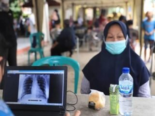Pemkot Tangerang layani skrining TBC gratis bagi 60.632 warga, dukung target Indonesia Bebas TBC 2030 dengan akses kesehatan setara.